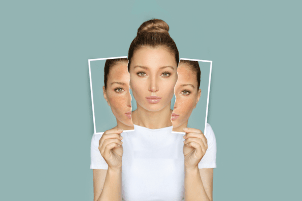 Skin whitening transformation